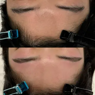 小顔/毛穴/ニキビ salon bealのエステ・リラクイメージ