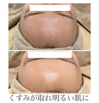 エステサロン Mi-mi.iのエステ・リラクイメージ