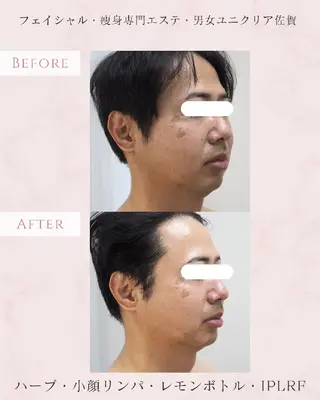 メンズ ユニセックスエステサロンUniclear所属・佐賀💎痩身エステ 夏までに痩せる🔥のエステ・リラクイメージ