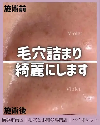 毛穴と耳つぼ専門店 バイオレット　りののその他イメージ