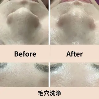 【小顔・毛穴ケア】 セラピスト　和田紋子のエステ・リラクイメージ