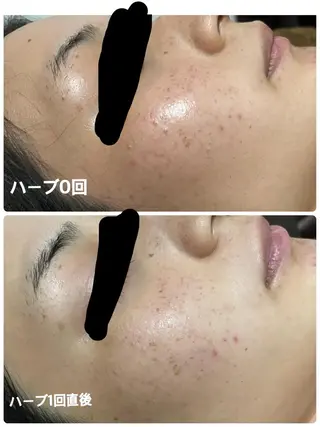 SALON BioBioのエステ・リラクイメージ