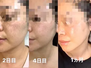 totalsalon R.sの眉毛・アイブロウイメージ