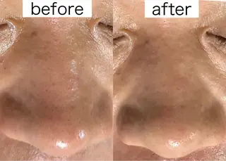 医療提携Beauty SalonMuseのエステ・リラクイメージ