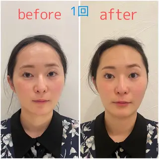 🌸美容鍼サロン🌸 メゾンブランシェ🌈のエステ・リラクイメージ