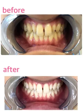 クリスタルラウンジ ホワイトニング銀座店のエステ・リラクイメージ