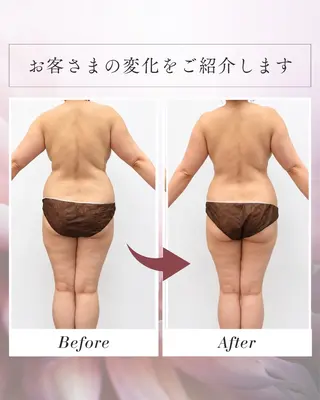 salon de Bellのエステ・リラクイメージ