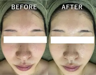 韓国美肌/肌質改善 【天神】のエステ・リラクイメージ