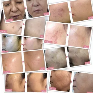 浅尾 順子のエステ・リラクイメージ