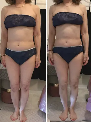 小顔美肌痩身サロン Ranのその他イメージ