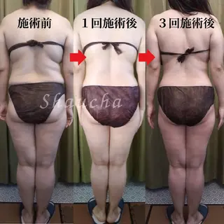 💎痩身エステサロン 💎シャウチャ奥多摩のエステ・リラクイメージ