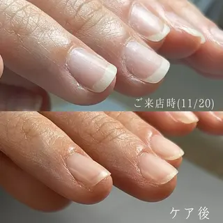 ネイル Aim* 深爪自爪育成専門店のネイルデザイン