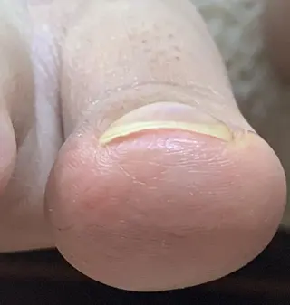 ネイル carenail　 tsugumiのその他イメージ