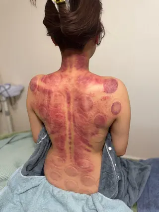 かっさ吸玉サロン Fluentのエステ・リラクイメージ