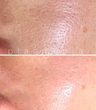 肌管理エステサロン｜ Connect ゆいのエステ・リラクイメージ