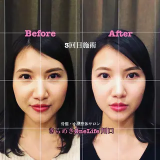 きらめきワンライフ Yumaのエステ・リラクイメージ