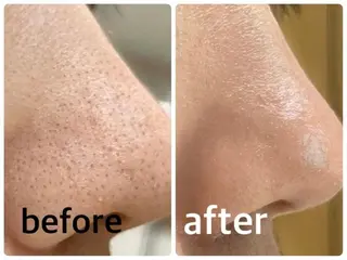 REBORN所属 藤木あおいのエステ・リラクイメージ