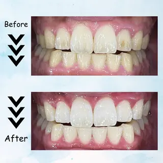 メンズ セルフホワイトニング エクシア塩釜口駅前店所属・セルフホワイトニング エクシア塩釜口駅前店のその他イメージ