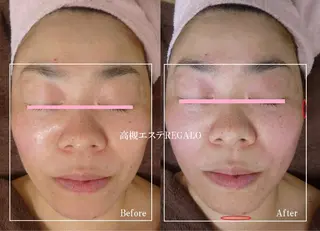 REGALO所属・矢野 さやかのエステ・リラクイメージ