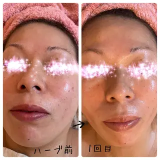 fairyrose organicエステのエステ・リラクイメージ