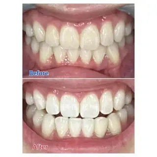 M渋谷 ホワイトニングのエステ・リラクイメージ