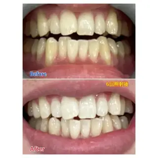 Ｍ渋谷 ホワイトニングのエステ・リラクイメージ