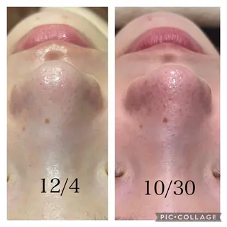 💫Linola💫 レイビス　小林のエステ・リラクイメージ