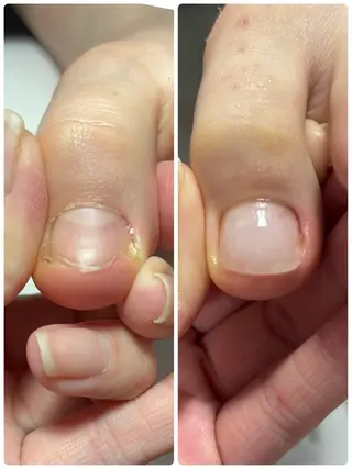 ネイル Alo.nail アロ•ネイルのネイルデザイン