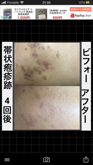 ショート カラー パーマ ヘアアレンジ メンズ キッズ ネイル マツエク・マツパ アイブロウ ハーブピーリング専門 🌿モッカのエステ・リラクイメージ