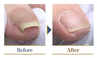 巻き爪補正店 横浜関内店のネイルデザイン