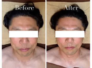 Avenir Brillant所属・松田 紗季のエステ・リラクイメージ