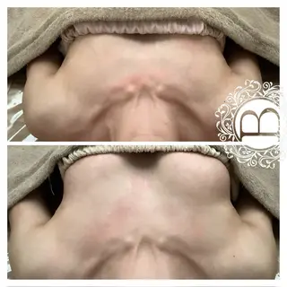 ミラクルバスト銀座本店所属・ミラクルバスト 銀座店のエステ・リラクイメージ