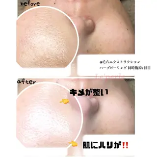 Le'perle。所属・Le'perle。 Kyokaのエステ・リラクイメージ