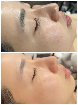 クラスペディア脱毛 ・フェイシャル専門店のエステ・リラクイメージ