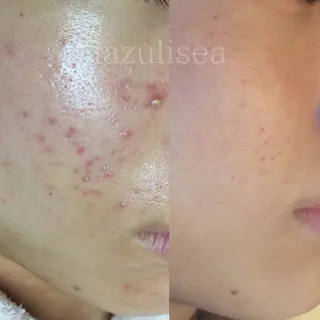 エステサロン Lazulisea所属・川口 春奈のエステ・リラクイメージ