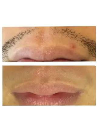 メンズ sourire スリールのエステ・リラクイメージ