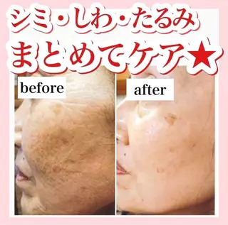 中目黒ハーブピーリン グ🌿ララピールのエステ・リラクイメージ