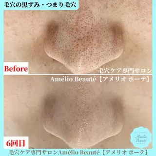 毛穴ケア専門サロン アメリオボーテのその他イメージ