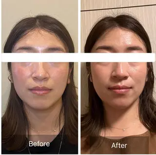 柳瀬 絵美のマツエク・マツパデザイン