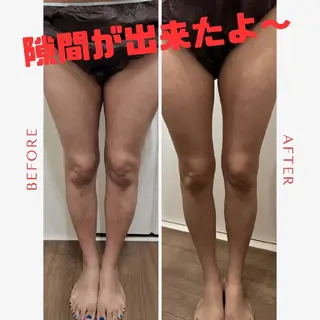 脂肪冷却・脱毛サロン coconoix のエステ・リラクイメージ