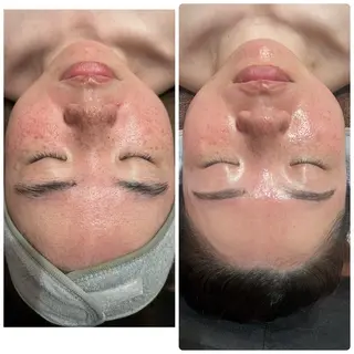 Beauty salon 705のエステ・リラクイメージ