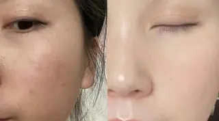 ネイル マツエク・マツパ aliaハーブ水光店 エステティシャン募集のエステ・リラクイメージ