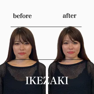 美容鍼 IKEZAKIのエステ・リラクイメージ