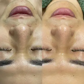 瑞穂区丸の内メナード 横山ともみのエステ・リラクイメージ