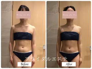 ブライダルサロン ｜Lino【堀江】のエステ・リラクイメージ