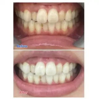 Ｍ渋谷 ホワイトニングのエステ・リラクイメージ