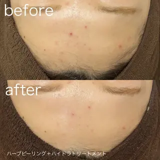 lulularico Yuのエステ・リラクイメージ