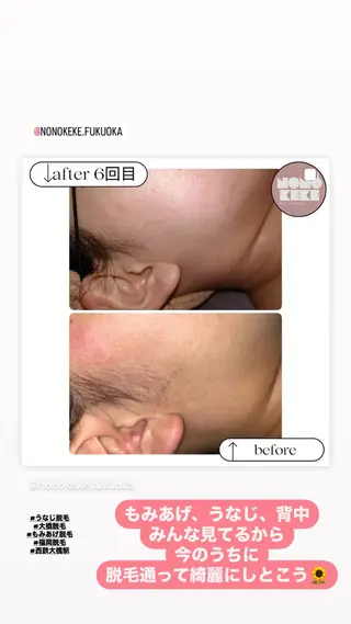 NONOKEKE ノノケケのエステ・リラクイメージ