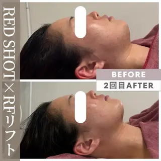 小顔矯正専門店 【RED】池田のエステ・リラクイメージ