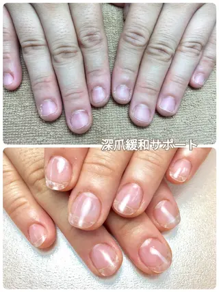 ネイル 深爪矯正/爪育成ケア manie nailのネイルデザイン